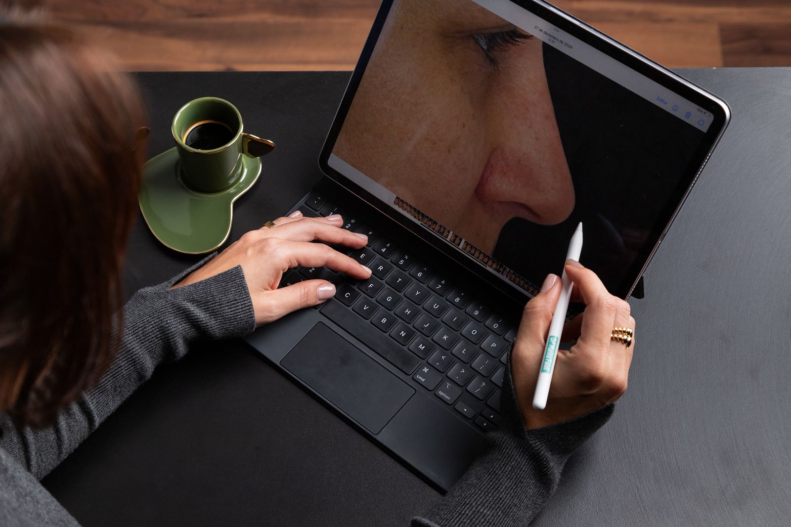 Dra. Marina Faioli - Rinoplastia